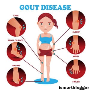 How to lower uric acid